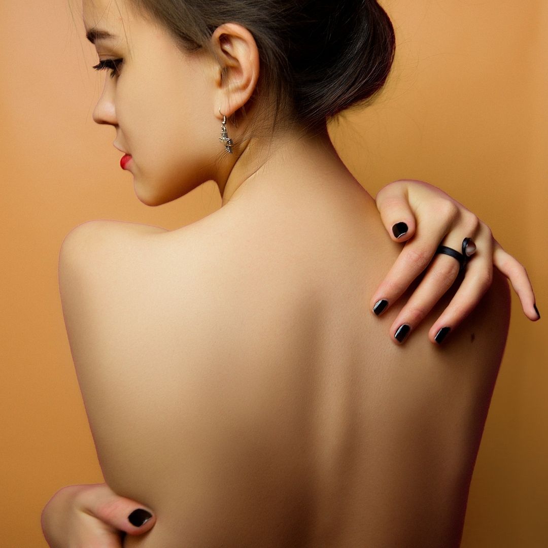  laser tattoo removal