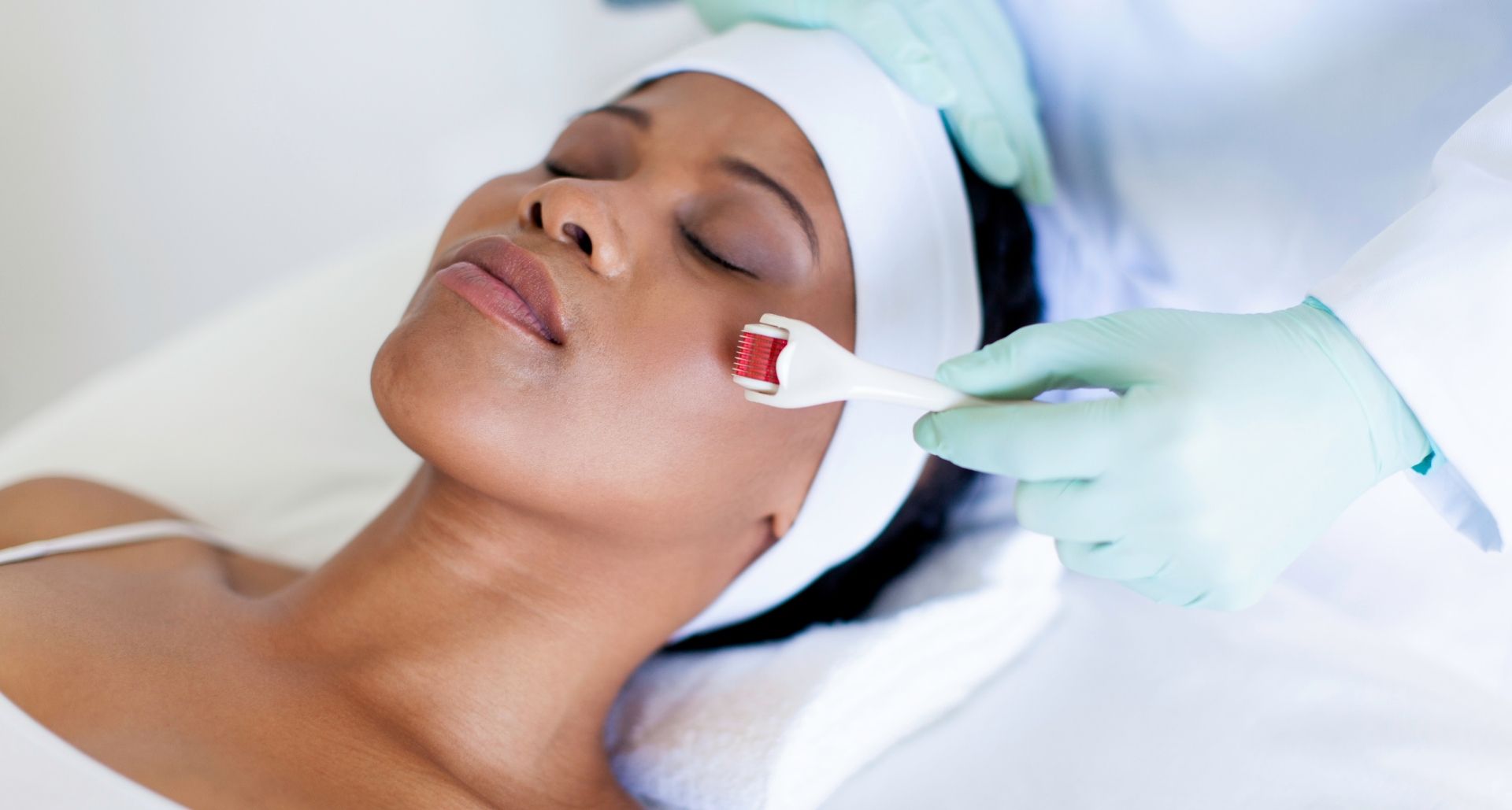 getting microneedling for better skin