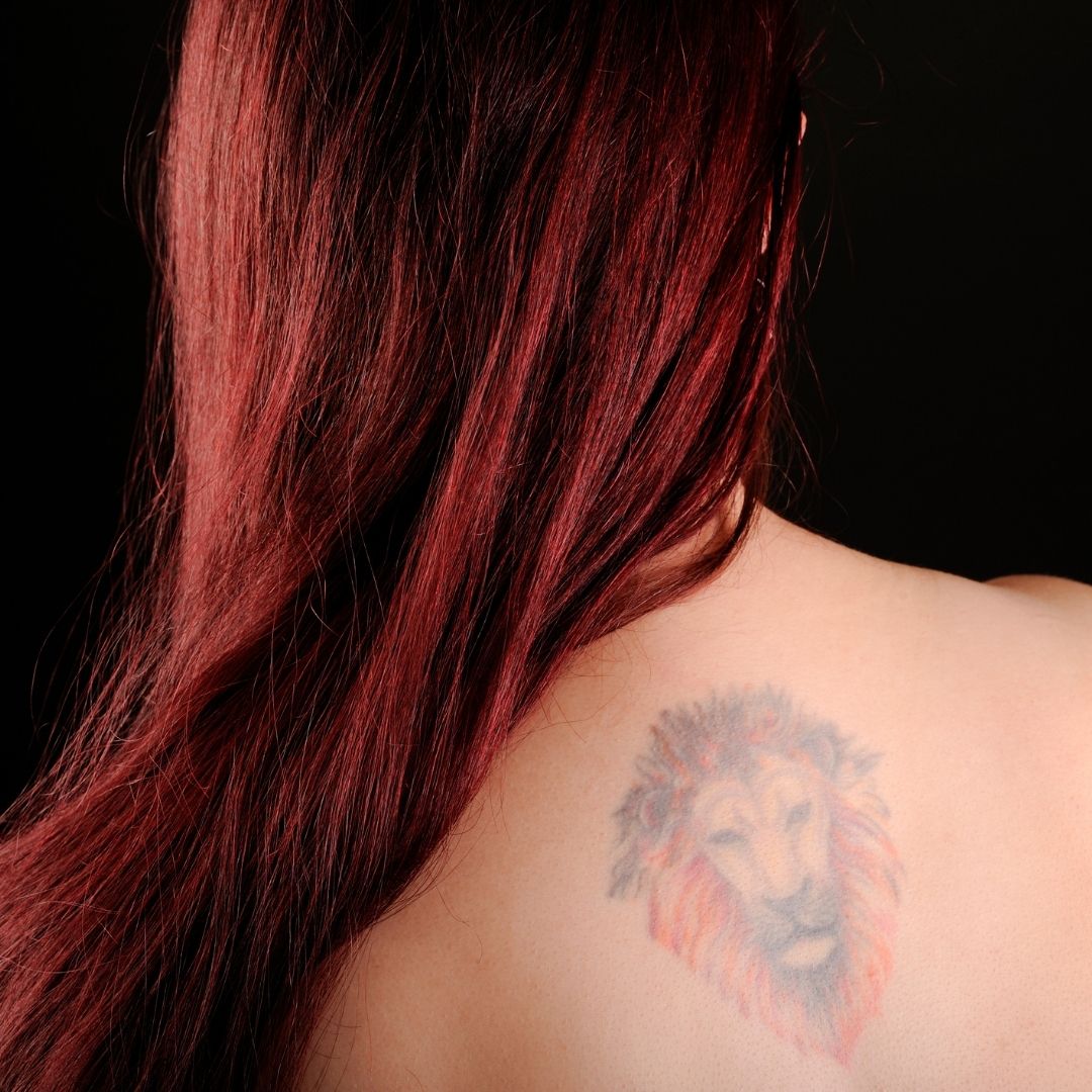 Update Your Tattoo with Lumenis Piqo4 Tattoo Removal - Jupiter Dermatology  & Hair Restoration