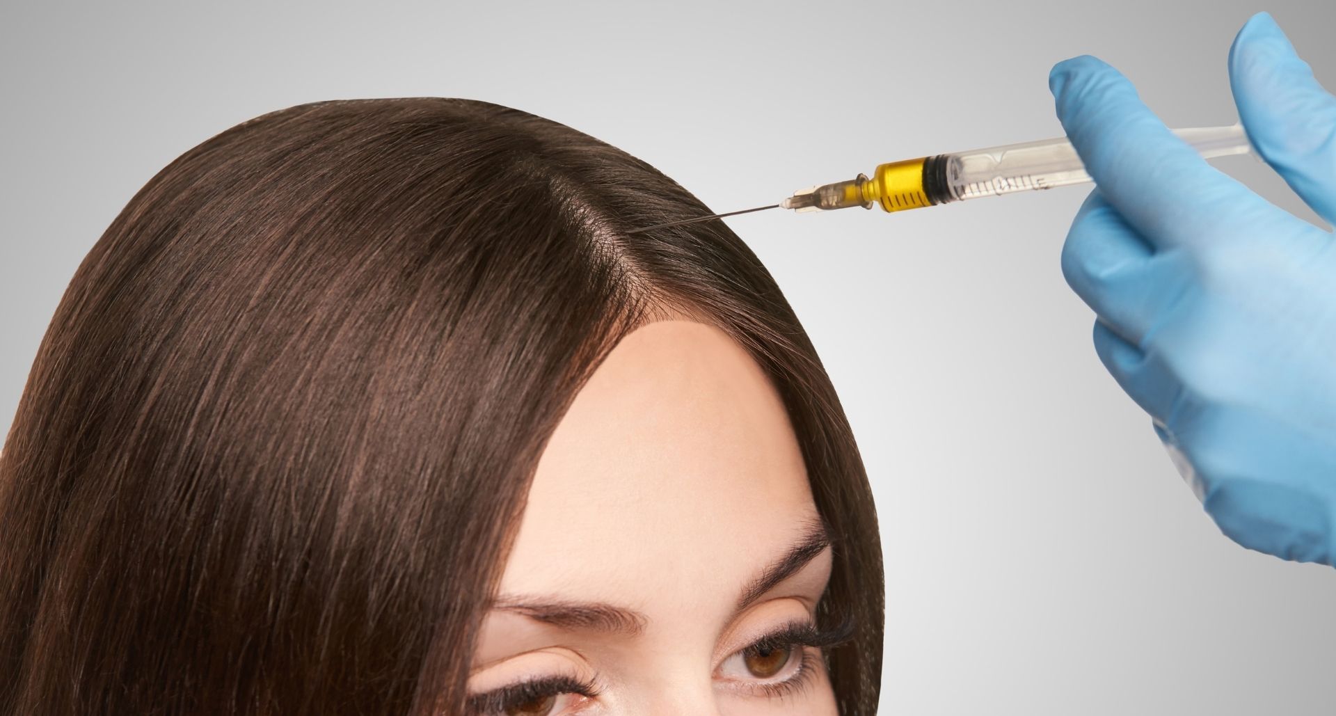 injection for hair loss 