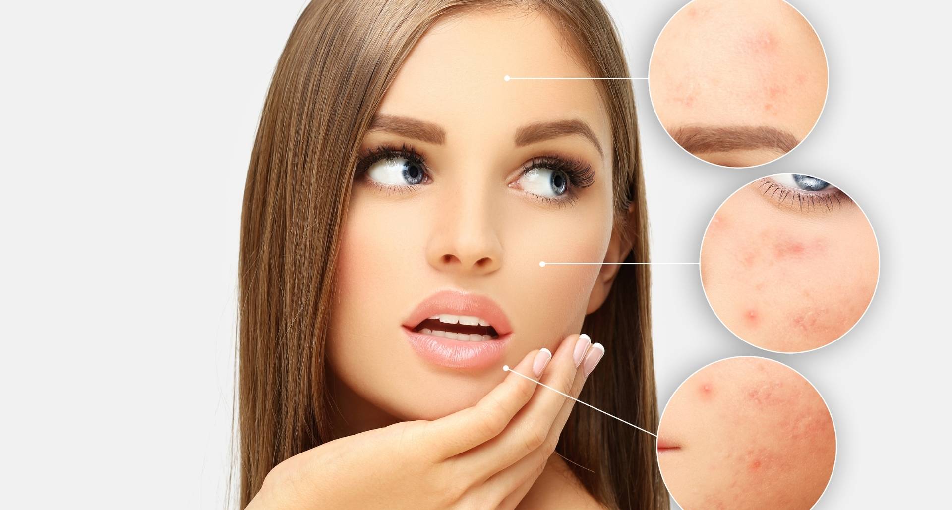 Side effects of laser skin resurfacing