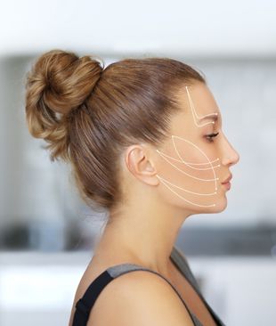 Woman after facial lifting procedure