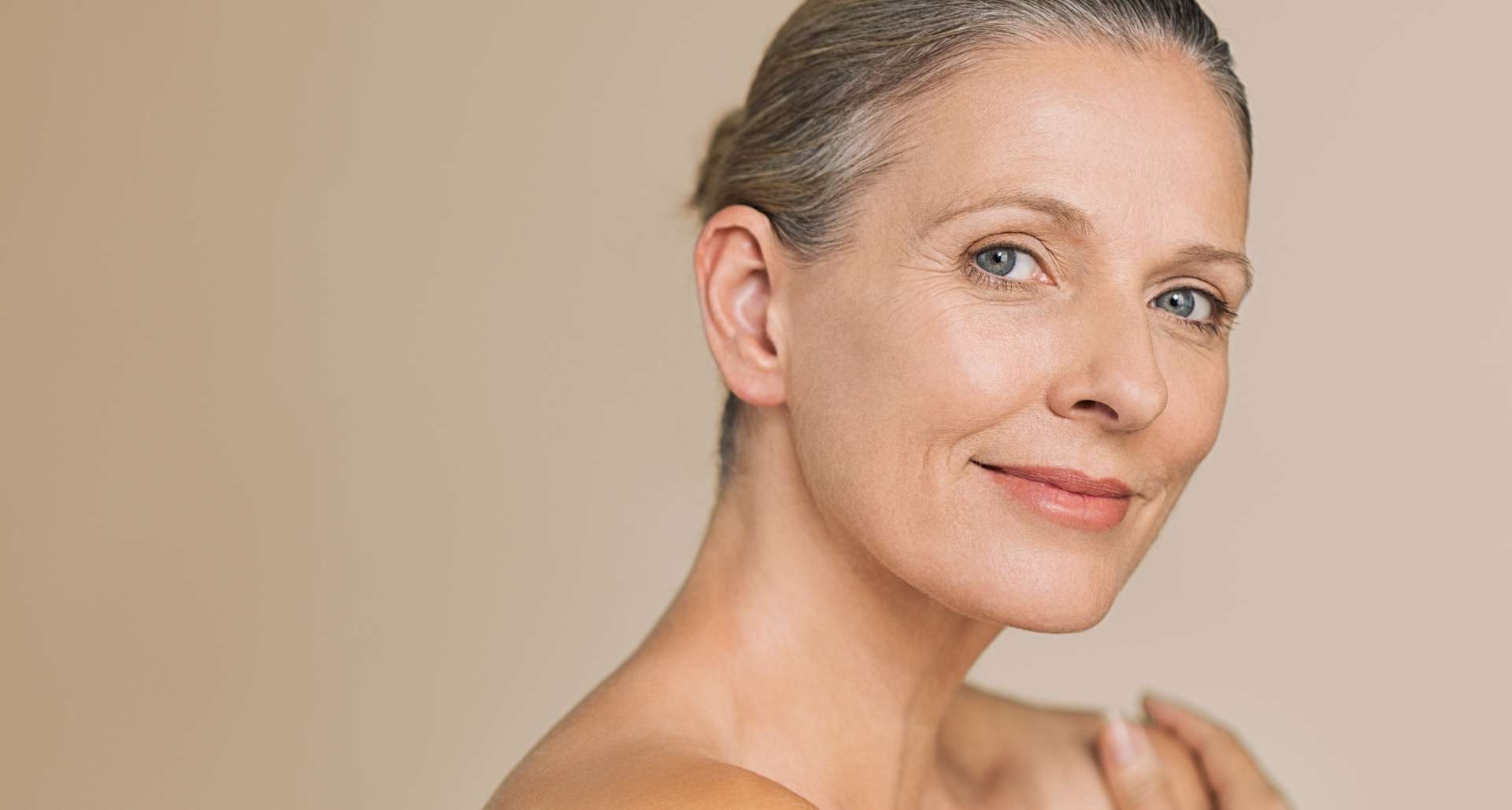 woman after Dysport treatment