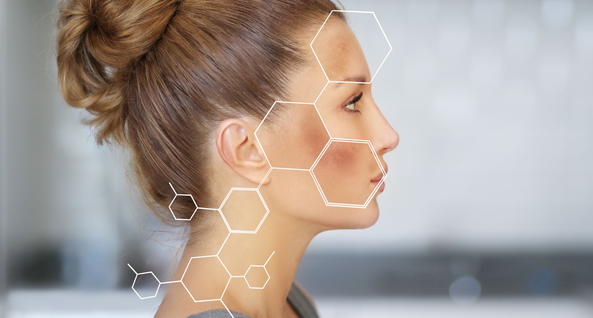 black spots on the skin