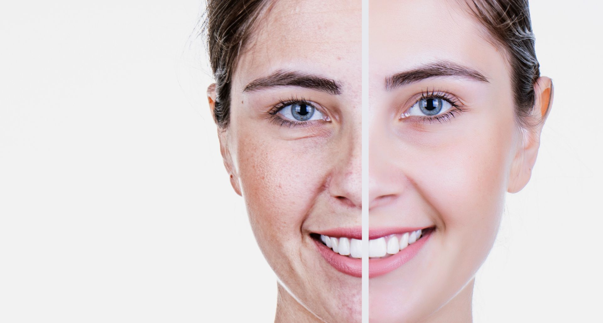 Benefits of Anti-Aging Facials picture