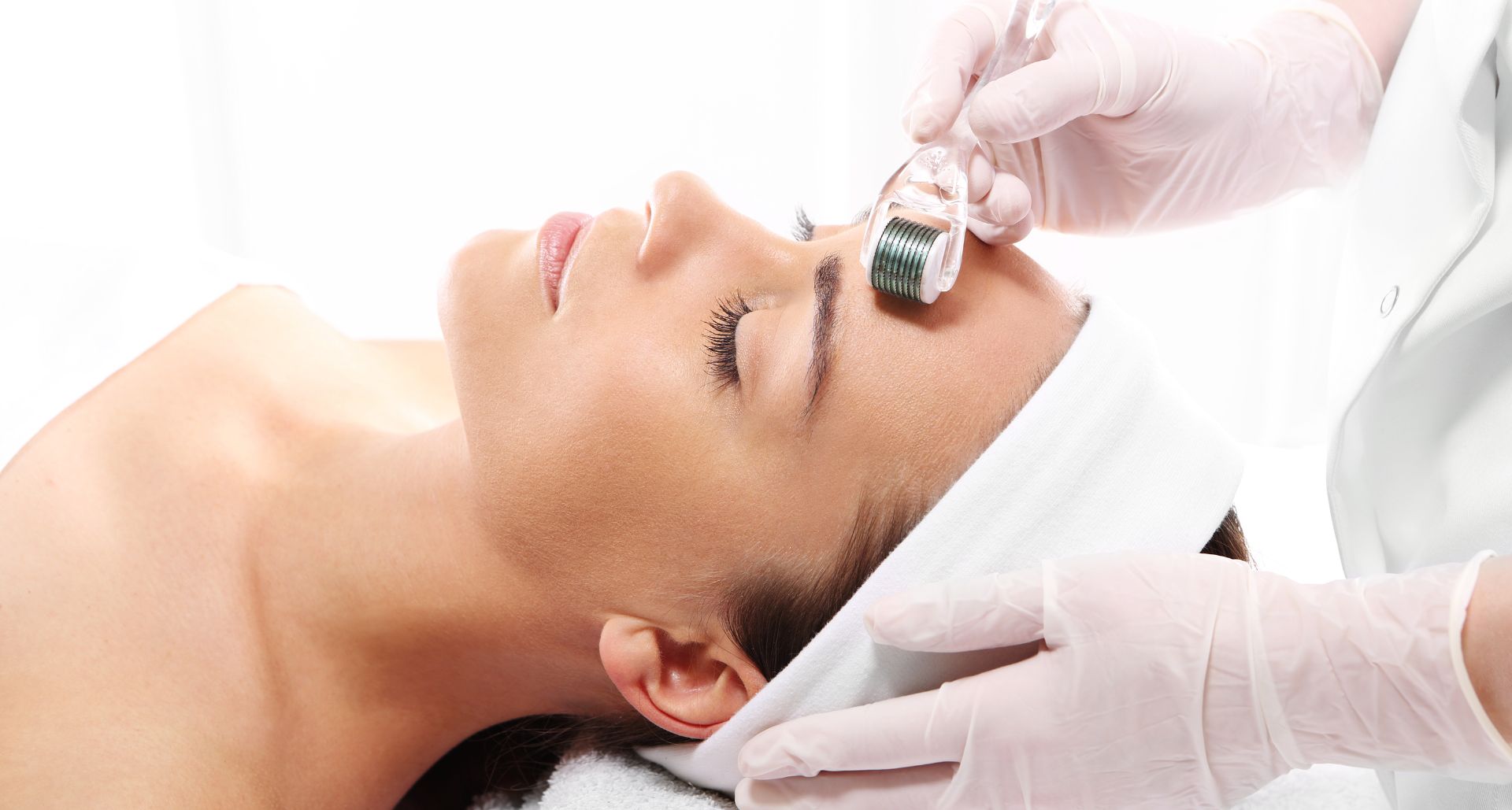 Microneedling