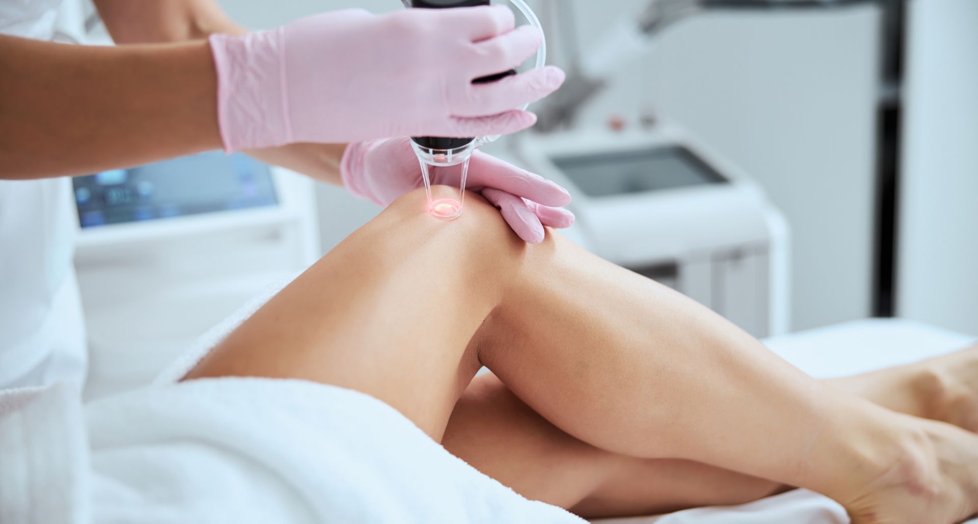 Laser Treatments for Spider Veins
