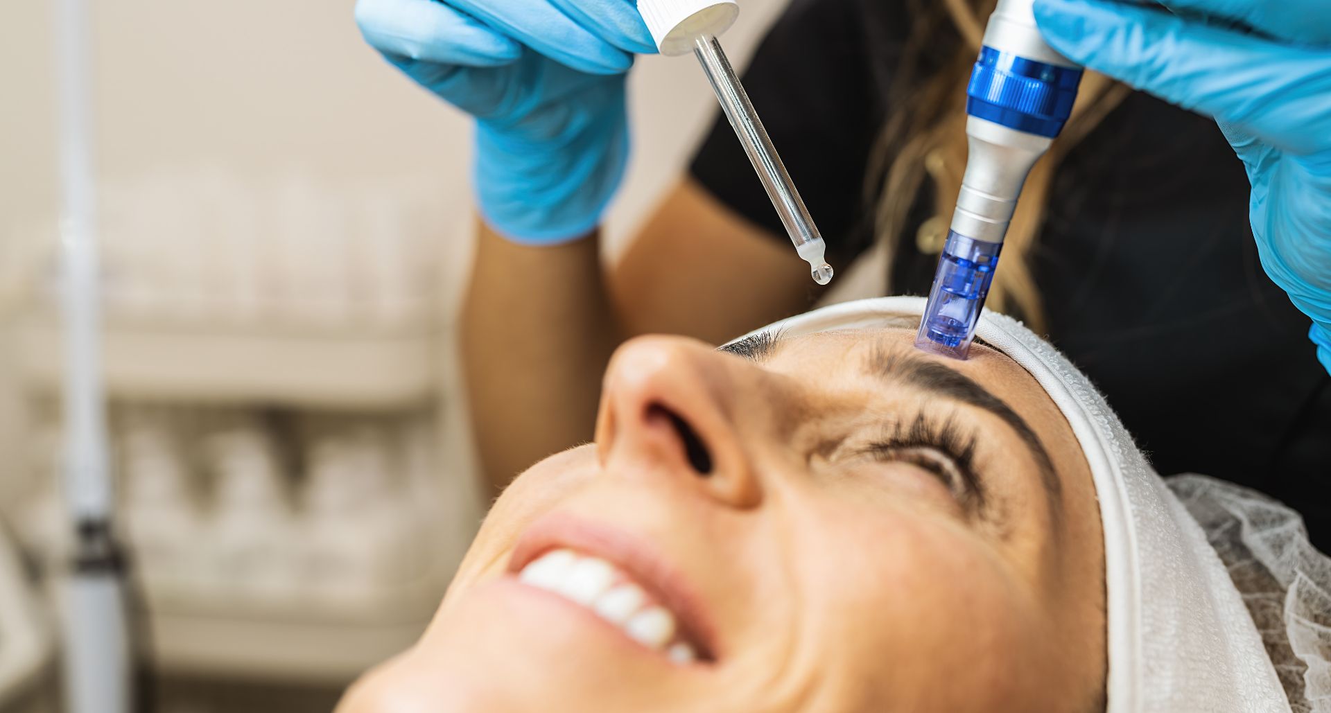 Microneedling treatment