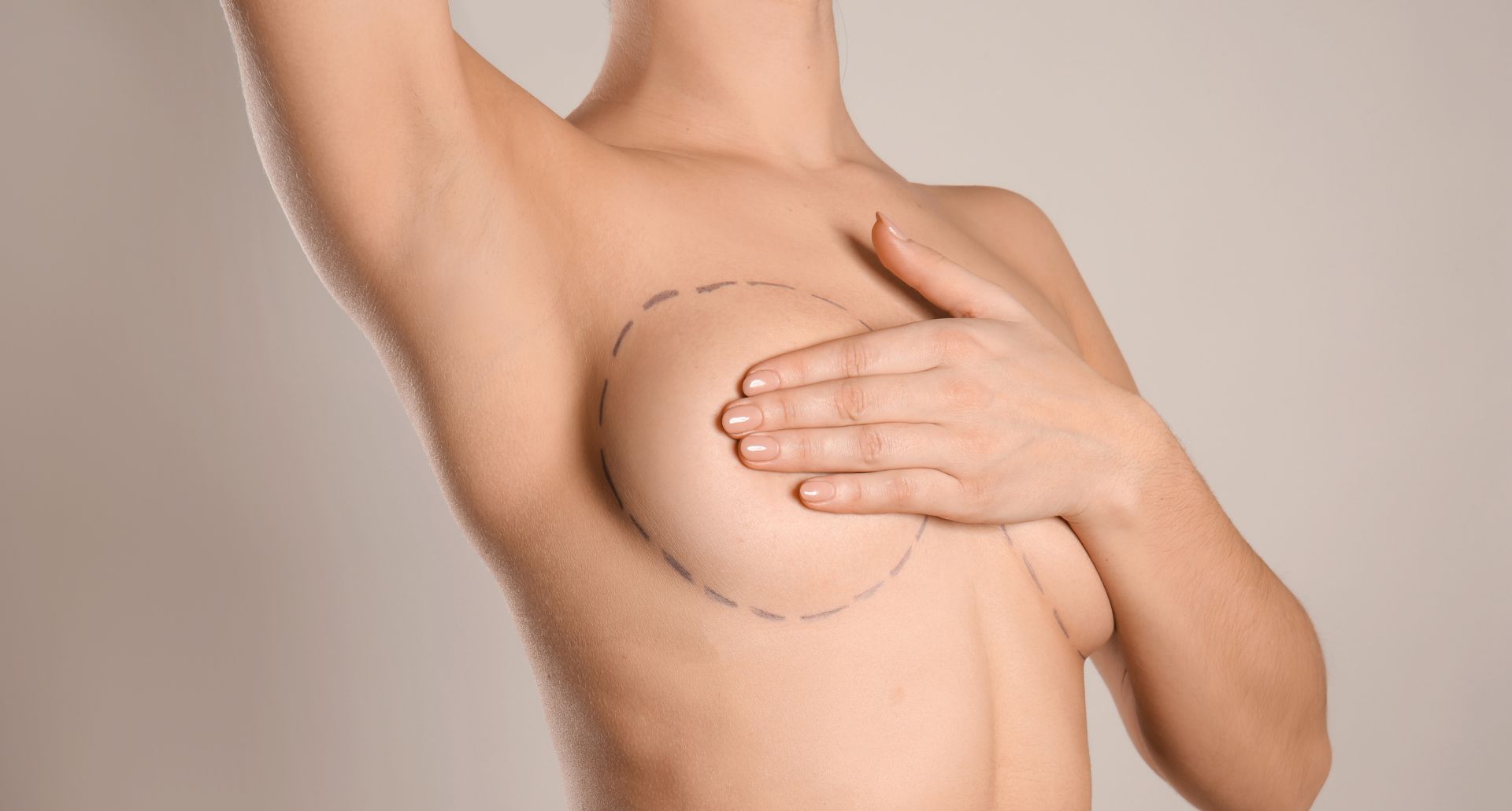 Young Woman with Marks on Breast for Cosmetic Surgery Operation against Grey Background